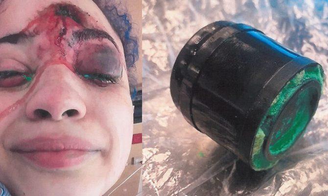ΜΕΛΒΟΥΡΝΗ…. Η ΔΗΜΟΚΡΑΤΙΑ ΚΑΟΥΤΣΟΥΚ ΒΟΗΘΑΕΙ ΣΤΗΝ ΥΓΕΙΑ – MELBOURNE …. RUBBER REPUBLIC HELPS HEALTH 20/9/21